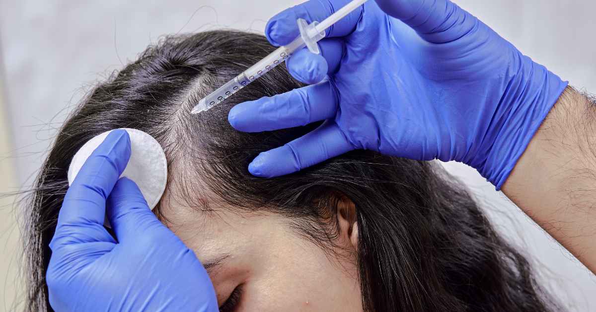 Best Dermatologist of Hair Loss in Guwahati