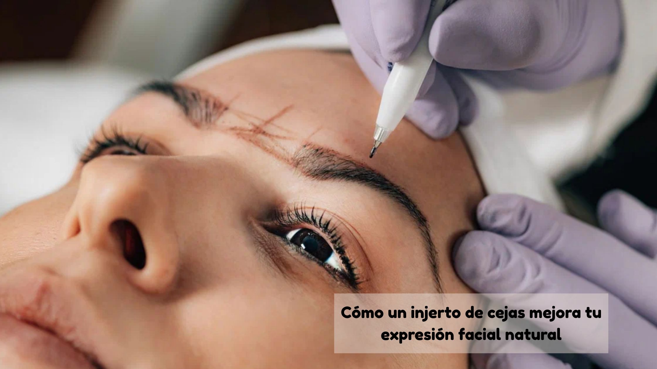 injerto de cejas
